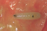 ceratitis02